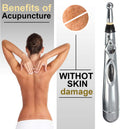 Acupuncture Pen - buyooze